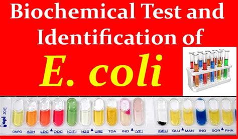 biochemical test for e.coli|bacterial identification tests.